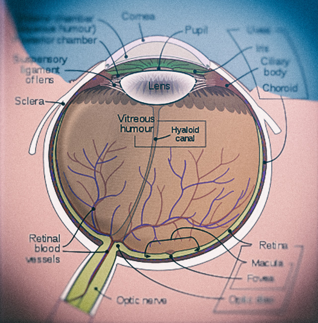 De oorzaak van glaucoom
